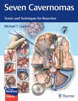 《近刊情報》 "Seven Cavernomas: Tenets & Techniques for Resection”