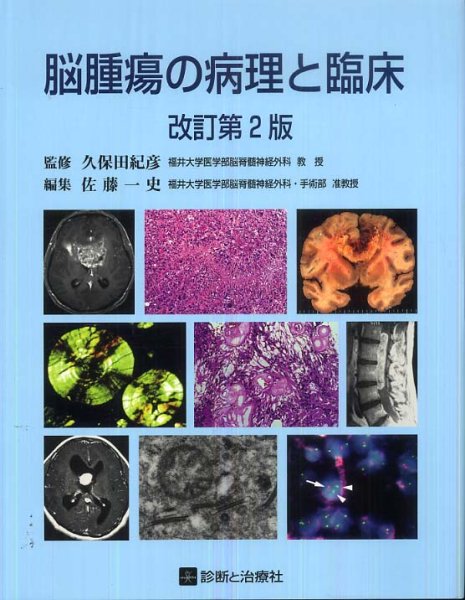 画像1: 脳腫瘍の病理と臨床（改訂第2版） (1)