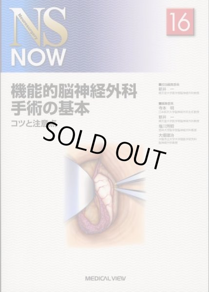 画像1: 機能的脳神経外科手術の基本 コツと注意点《NS NOW 16》 (1)
