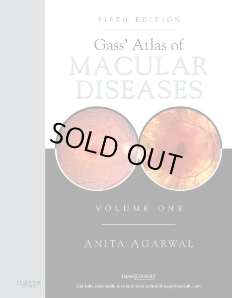 画像1: Gass' Atlas of Macular Diseases 5th.Edition - Expert Consult: Online and Print 2-Volume Set (1)