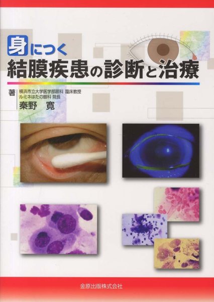 画像1: 身につく結膜疾患の診断と治療 (1)