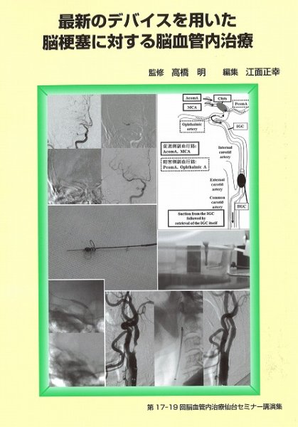 画像1: 最新のデバイスを用いた脳梗塞に対する脳血管内治療《第17-19回脳血管内治療仙台セミナー講演集》 (1)