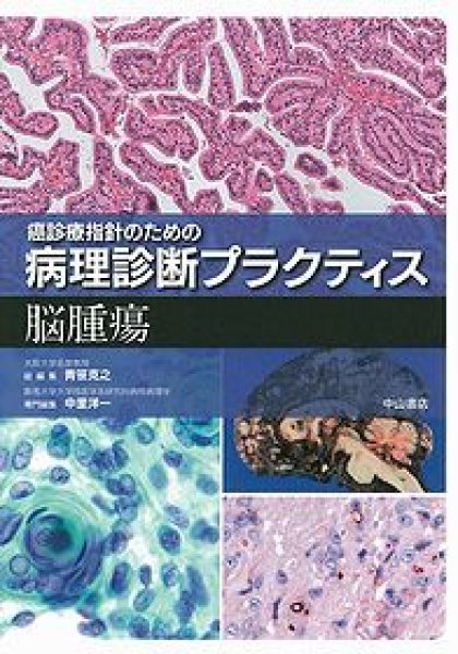 画像1: 脳腫瘍 （癌診療指針のための病理診断プラクティス ） (1)