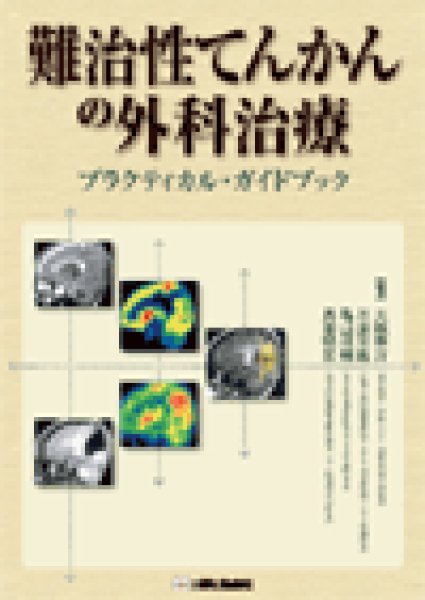 画像1: 難治性てんかんの外科治療プラクティカル・ガイドブック (1)