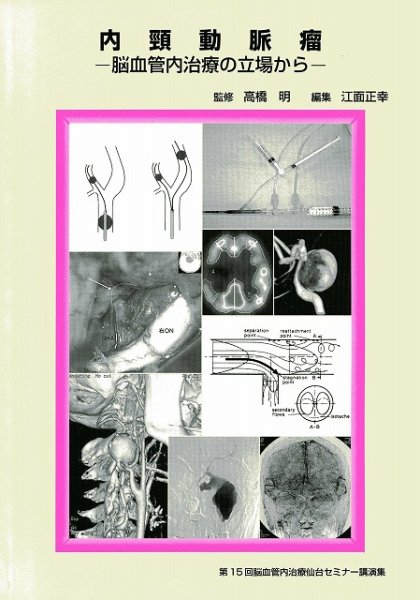 画像1: 内頸動脈瘤　－脳血管内治療の立場から－《第15回脳血管内治療仙台セミナー講演集》 (1)