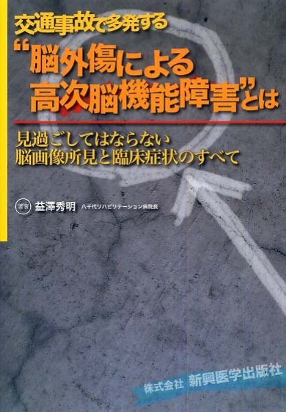 画像1: 交通事故で多発する“脳外傷による高次脳機能障害”とは (1)