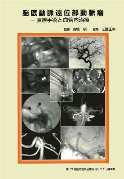 画像1: 脳底動脈遠位部動脈瘤　－直達手術と血管内治療－《第13回脳血管内治療仙台セミナー講演集》 (1)