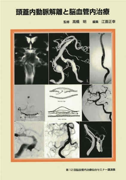 画像1: 頭蓋内動脈解離と脳血管内治療《第12回脳血管内治療仙台セミナー講演集》 (1)