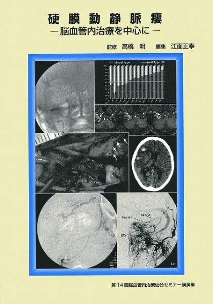 画像1: 硬膜動静脈瘻　－脳血管内治療を中心に－《第14回脳血管内治療仙台セミナー講演集》 (1)