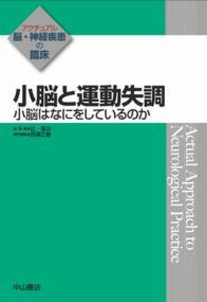 画像1: 小脳と運動失調《アクチュアル　脳・神経疾患の臨床》 (1)