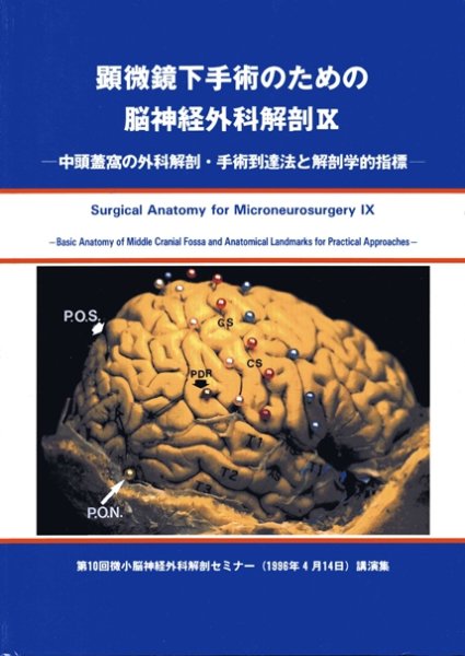 画像1: 顕微鏡下手術のための脳神経外科解剖 IX 中頭蓋窩の外科解剖・手術到達法と解剖学的指標 (1)