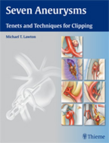 画像1: Seven Aneurysms Tenets and Techniques for Clipping (1)