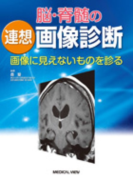 メディカルブックサービス　脳・脊髄の連想画像診断　画像に見えないものを診る　online　shop