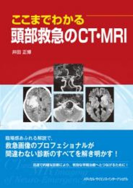 画像1: ここまでわかる頭部救急のCT・MRI (1)