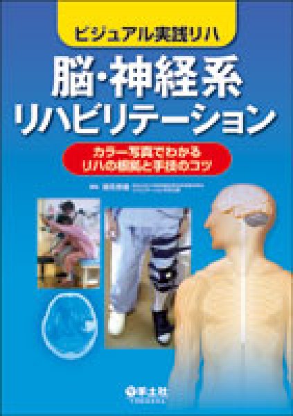 画像1: 《ビジュアル実践リハ》 脳・神経系リハビリテーション カラー写真でわかるリハの根拠と手技のコツ (1)