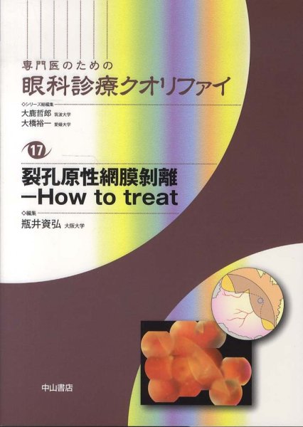 画像1: 裂孔原性網膜剥離－How to treat　[専門医のための眼科診療クオリファイ　17] (1)