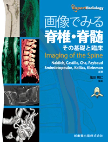 画像1: 画像でみる脊椎・脊髄  その基礎と臨床 (1)