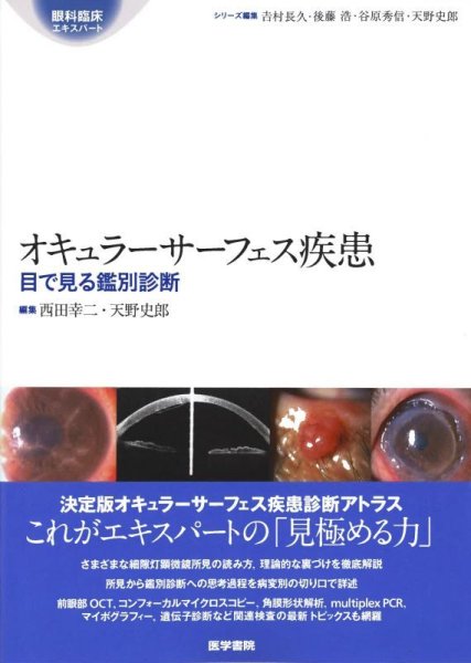 画像1: オキュラーサーフェス疾患　目で見る鑑別診断　[眼科臨床エキスパート] (1)