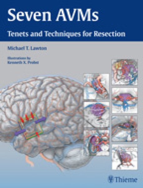 画像1: Seven AVMs Tenets and Techniques for Resection (1)