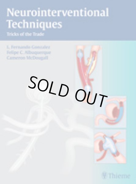 画像1: Neurointerventional Techniques Tricks of the Trade (1)