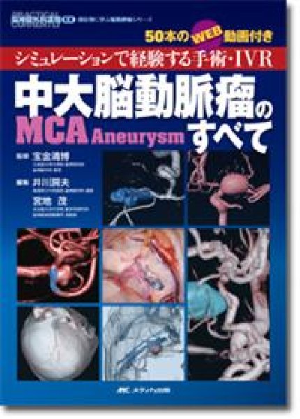 画像1: 《電子書籍.m3.com》中大脳動脈瘤（MCA Aneurysm）のすべて (1)