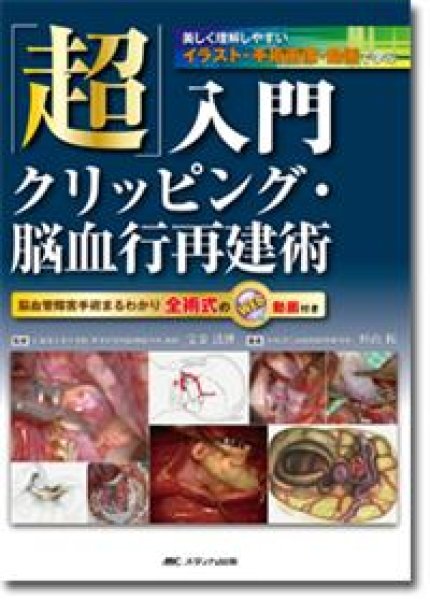 画像1: 「超」入門　クリッピング・脳血行再建術 (1)