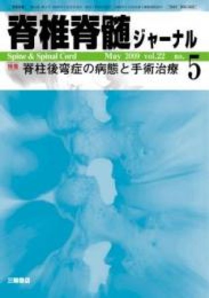 画像1: 【脊椎脊髄ジャーナル 2009年05月増大号】脊柱後弯症の病態と手術治療 (1)