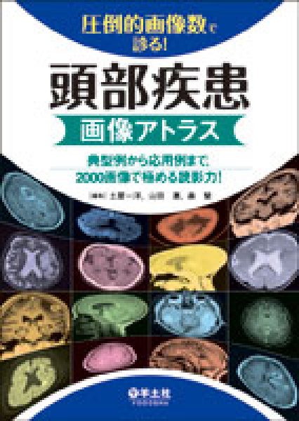 画像1: 圧倒的画像数で診る！ 頭部疾患画像アトラス (1)