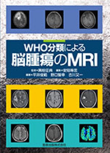 画像1: WHO分類による脳腫瘍のMRI (1)