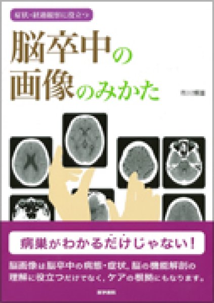 画像1: 症状・経過観察に役立つ 脳卒中の画像のみかた (1)