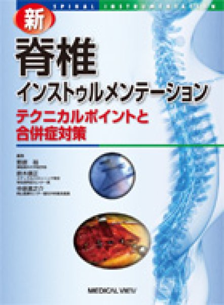 画像1: 新　脊椎インストゥルメンテーション テクニカルポイントと合併症対策 (1)