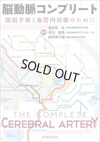 画像1: 脳動脈コンプリート 開頭手術と血管内治療のために (1)