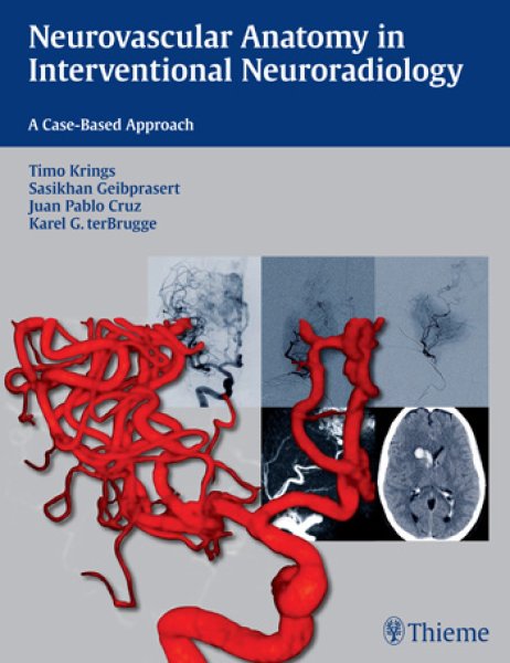 画像1: Neurovascular Anatomy in Interventional Neuroradiology: A Case-Based Approach (1)