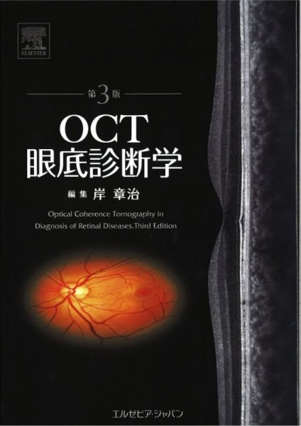 画像1: OCT眼底診断学　第3版 (1)