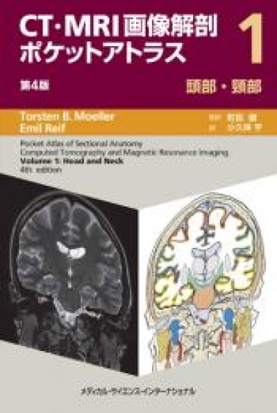 頭部画像解剖 徹頭徹尾―疾患を見極め的確に診断する