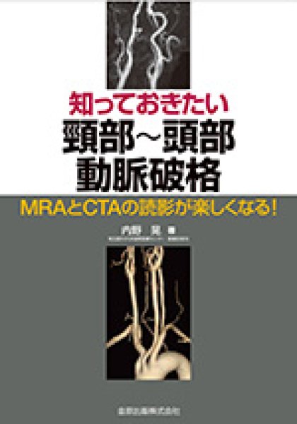 画像1: 《電子書籍.m3.com》知っておきたい頸部〜頭部動脈破格 MRAとCTAの読影が楽しくなる！ (1)