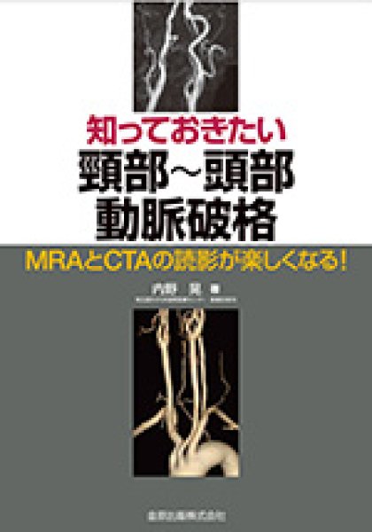 画像1: 知っておきたい頸部〜頭部動脈破格 MRAとCTAの読影が楽しくなる！ (1)