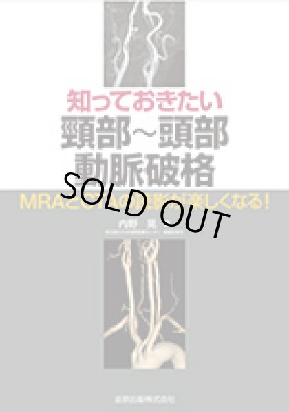 画像1: 知っておきたい頸部〜頭部動脈破格 MRAとCTAの読影が楽しくなる！ (1)