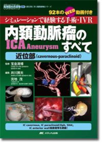 shop　内頚動脈瘤（ICA　online　Aneurysm）のすべて－近位部（cavernous-paraclinoid）　メディカルブックサービス