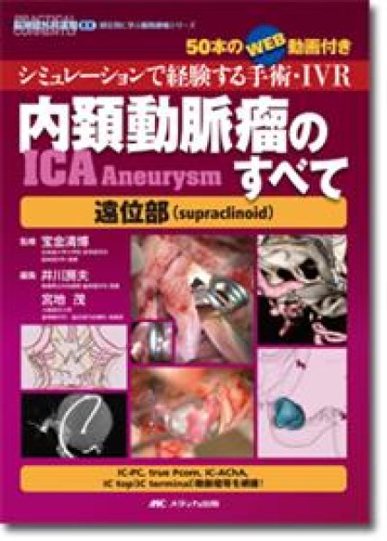 画像1: 内頚動脈瘤（ICA Aneurysm）のすべて－遠位部（supraclinoid） (1)