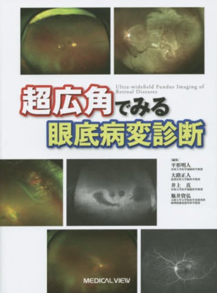 画像1: 超広角でみる眼底病変診断 (1)