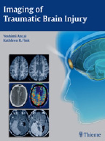 画像1: Imaging of Traumatic Brain Injury (1)