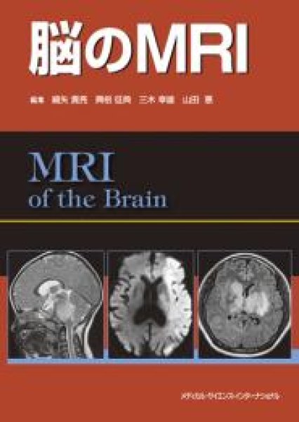 画像1: 脳のMRI (1)