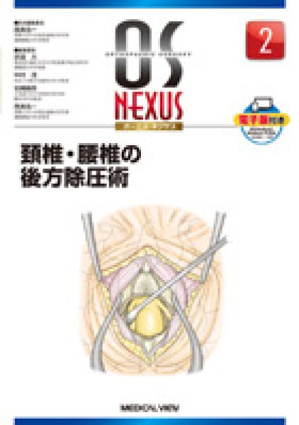 画像1: OS NEXUS（電子版付き） 2 頚椎・腰椎の後方除圧術 (1)