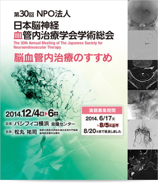 画像1: CEP 2014 動画+TEXT 【第30回日本脳神経血管内治療学会総会生涯教育プログラム】 (1)