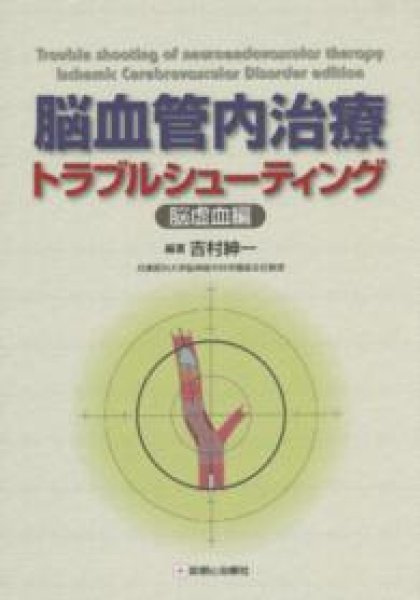 画像1: 脳血管内治療トラブルシューティング－脳虚血編－ (1)