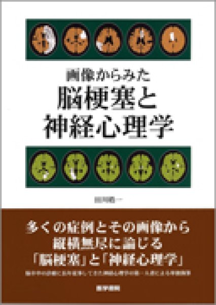 画像1: 画像からみた 脳梗塞と神経心理学 (1)