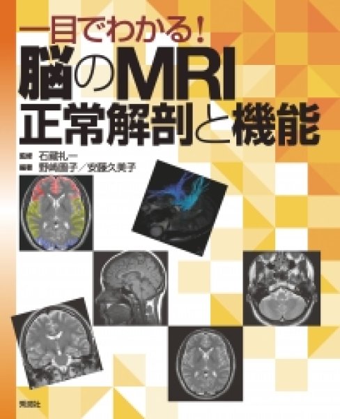 画像1: 一目でわかる！脳のＭＲＩ正常解剖と機能  (1)