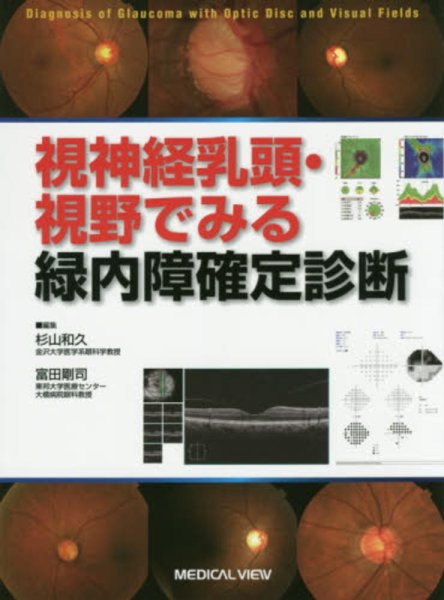 画像1: 視神経乳頭・視野でみる緑内障確定診断 (1)