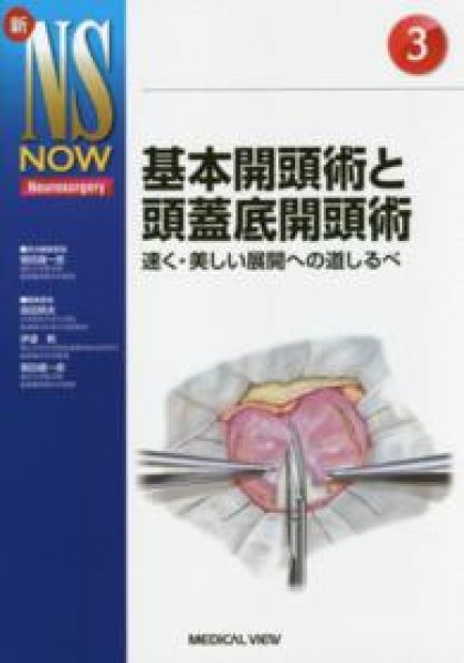 画像1: 【新NS NOW 3】基本開頭術と頭蓋底開頭術 (1)